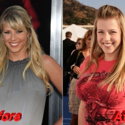 Jodie Sweetin Plastic Surgery: Uncovering the Truth